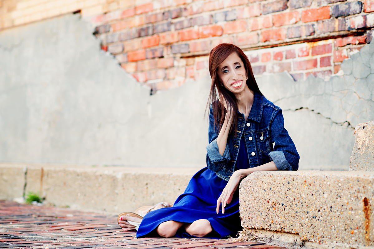 Lizzie Velasquez